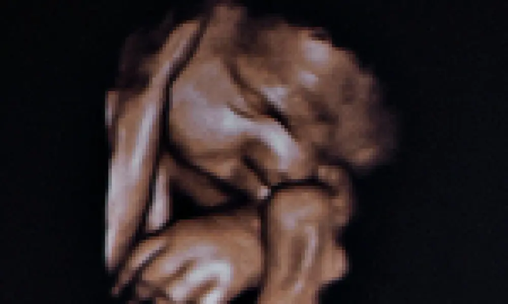 4D Ultraschalluntersuchung